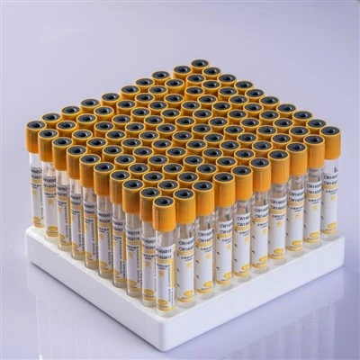 Serum Separation Gel Clot Activator Tube Serum Separation Gel Clot Activator Tube